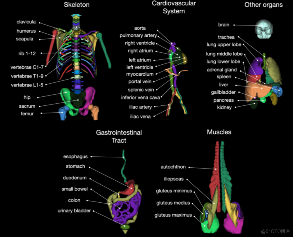 在3D Slicer中使用 Monai Bundle 和 Model Zoo 标注医学影像数据-全身CT器官分割_计算机视觉_02