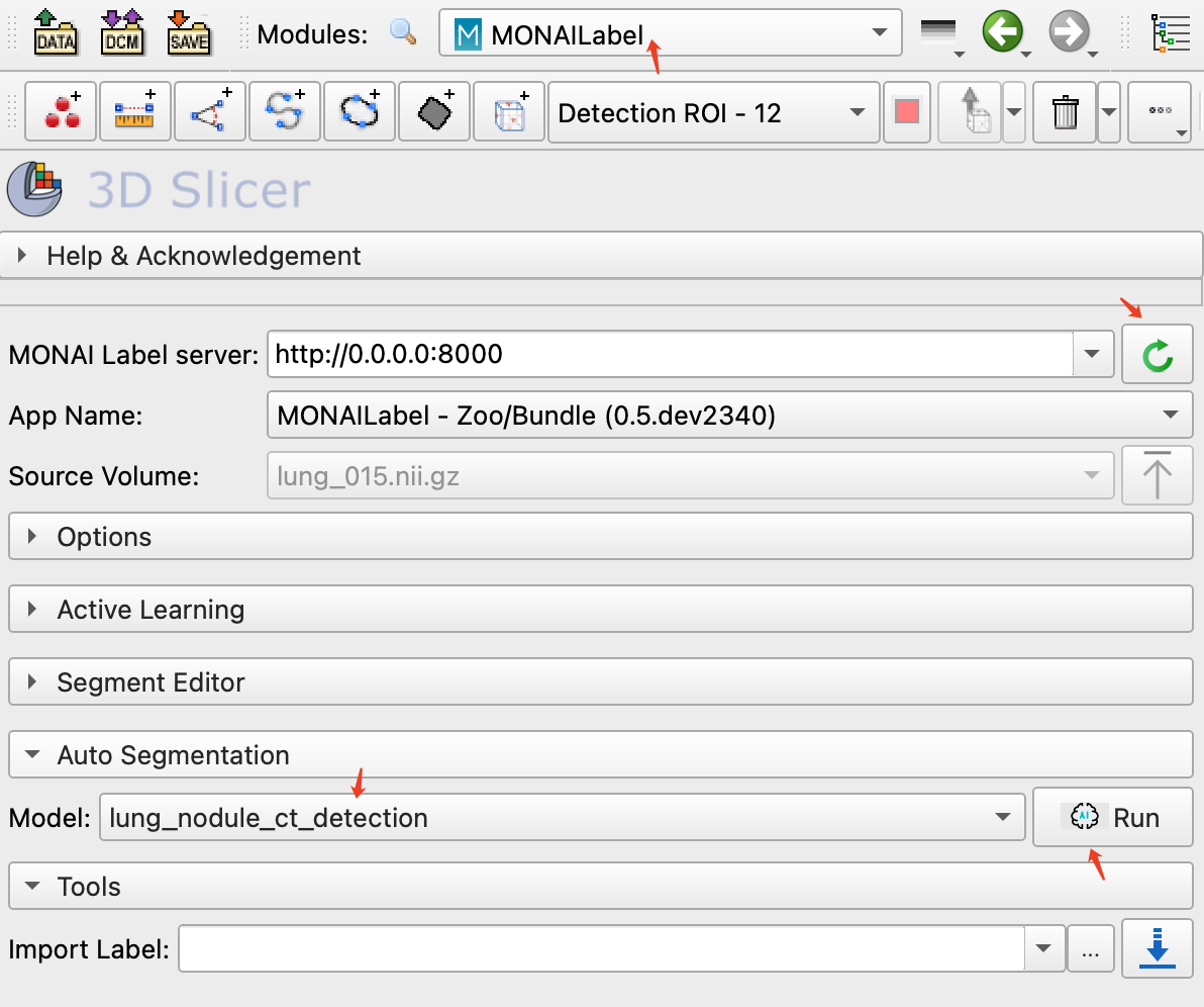 在3D Slicer中使用 Monai Bundle 和 Model Zoo 标注医学影像数据-CT肺结节检测_数据_04