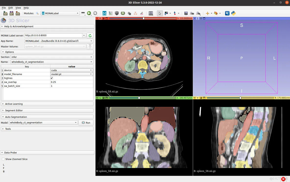 在3D Slicer中使用 Monai Bundle 和 Model Zoo 标注医学影像数据-全身CT器官分割_数据_06