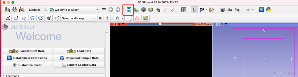 在3D slicer中使用MONAI Label 辅助标注提升标注速度-安装教程_计算机视觉_03