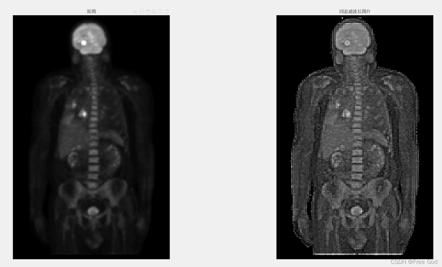 同态滤波器opencv_均衡化