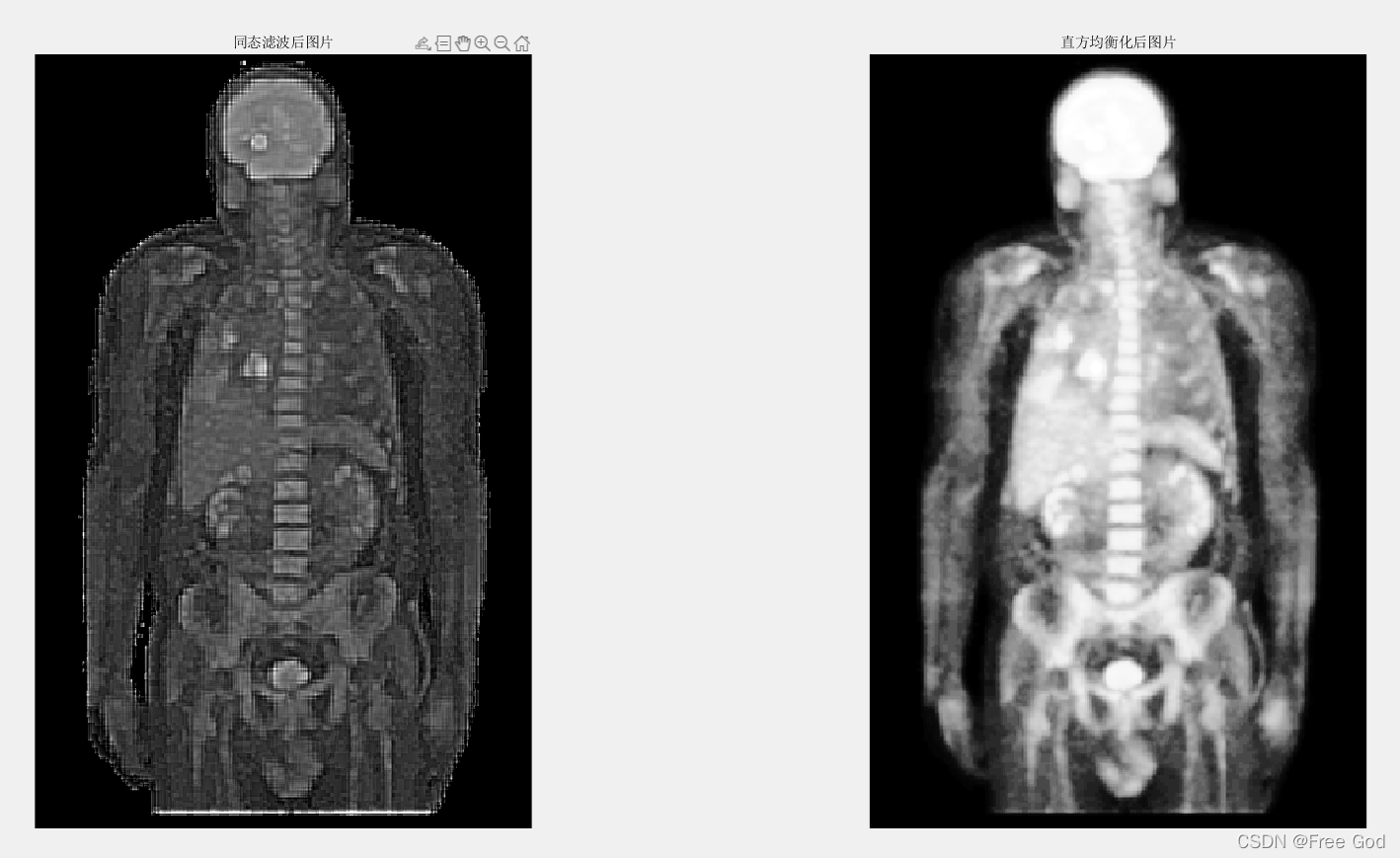 同态滤波器opencv_同态滤波器opencv_03