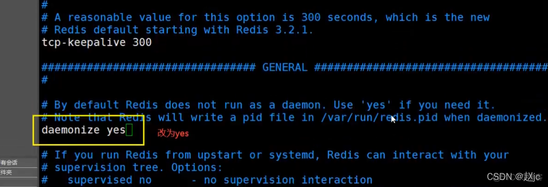 ycsb 测试redis_Redis_07