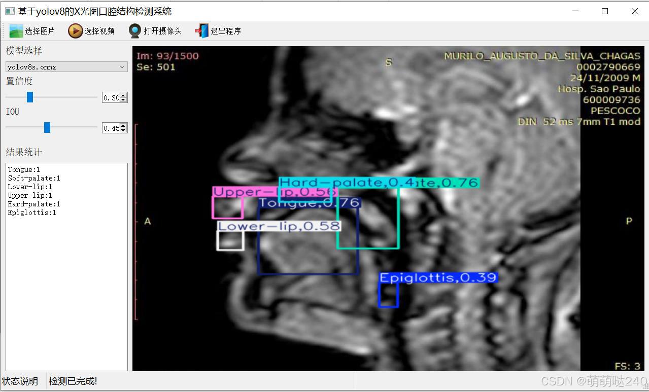 基于yolov8的X光图口腔结构检测系统python源码+onnx模型+评估指标曲线+精美GUI界面_Qt