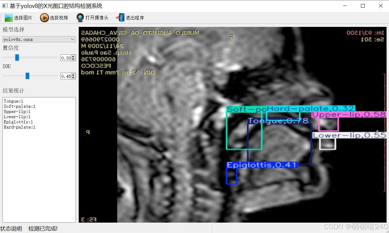 基于yolov8的X光图口腔结构检测系统python源码+onnx模型+评估指标曲线+精美GUI界面_v8_02