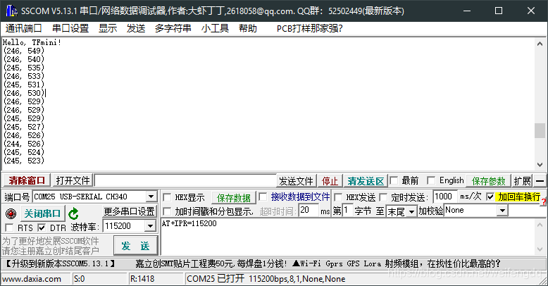 es会话连接数怎么设置_STC89_03