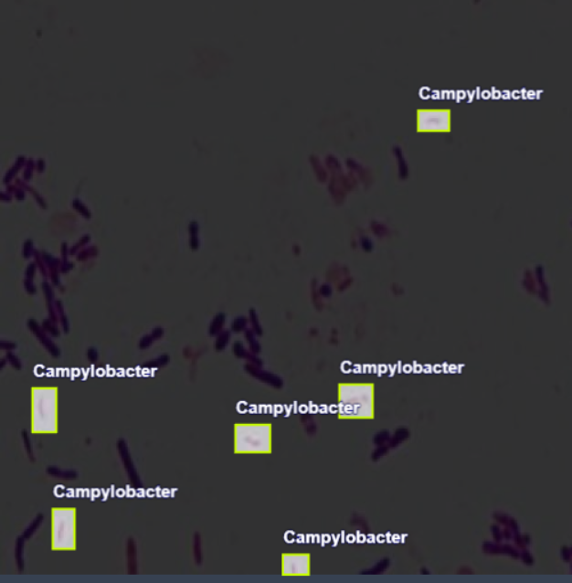 细菌和肺炎支原体识别数据集，对5936张原始图片进行手动标注，支持yolo，voc，coco格式，可识别弯曲杆菌，葡萄球菌，绿脓杆菌，肺炎链球菌，肺炎支原体等_深度学习_04