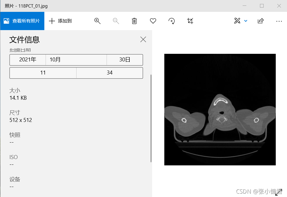 dicom java医学影像_深度学习_08