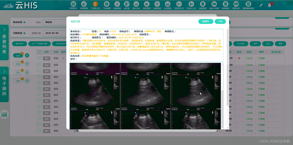 推荐8套医疗信息化系统（源代码），HIS、LIS、PACS、智慧导诊、线上预约挂号平台源码_系统源码