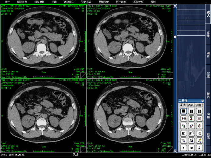 带三维重建和还原的PACS源码 医学影像PACS系统源码_系统管理员_04