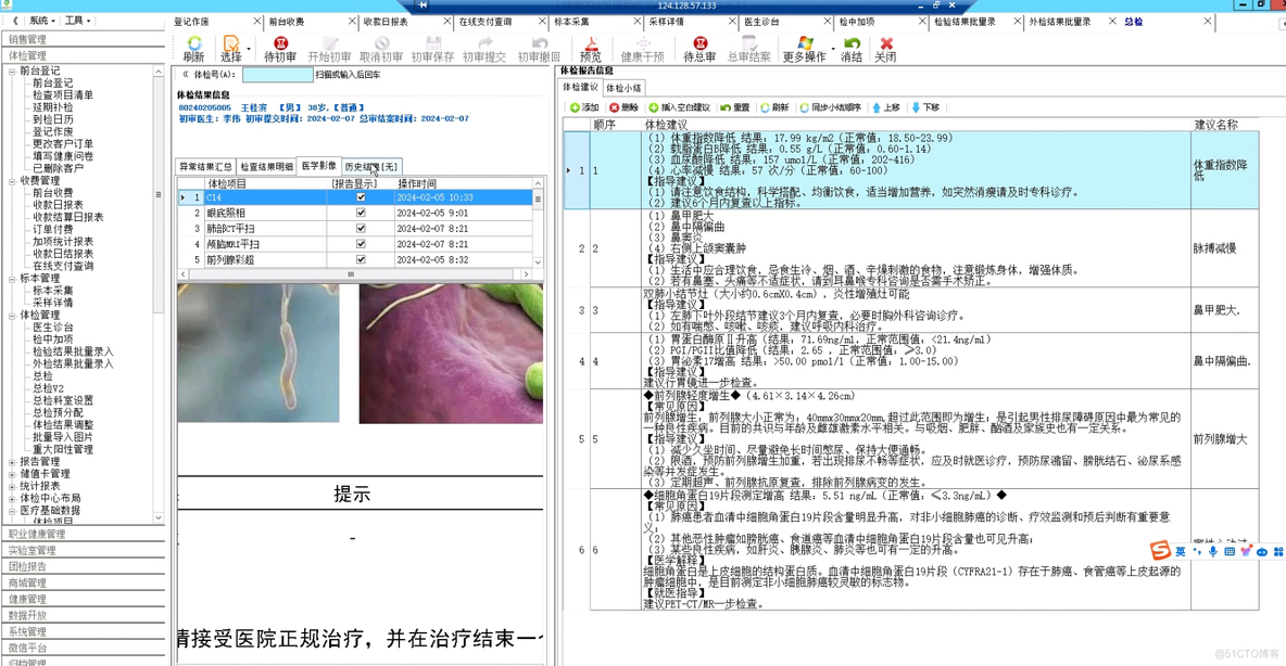 C#健康体检信息管理系统源代码，与HIS、LIS、PACS等各类系统实现无缝对接_工作效率_02