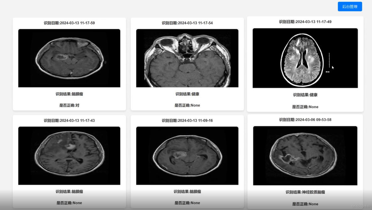 基于深度学习的医学图像诊断系统-计算机毕业设计源码+LW文档_深度学习_03