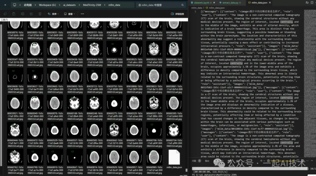 我训练了一个医疗多模态大模型帮家里老人看病-AI.x社区